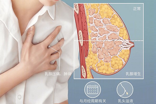乳腺增生不良生活習慣